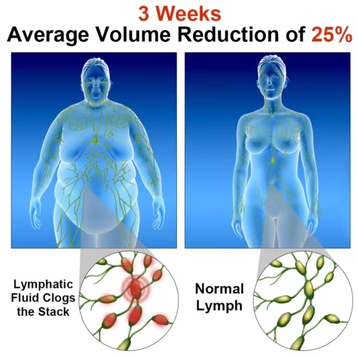 GFOUK™ Electric Pulse Lymphatic Drainage - Image 3