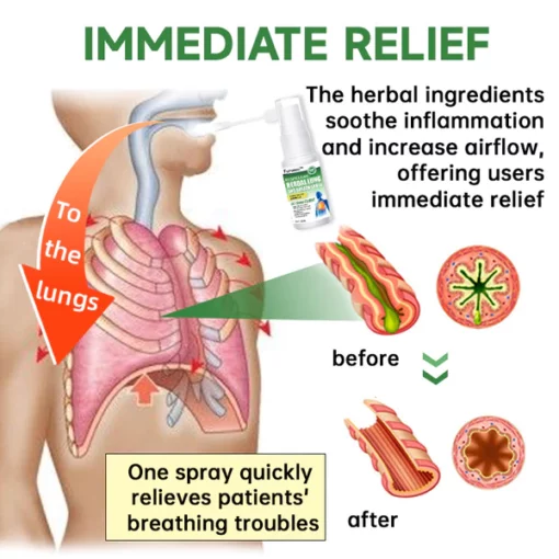 Furzero™️ RespiClean Herbal Lung and Breath Spray - Image 3