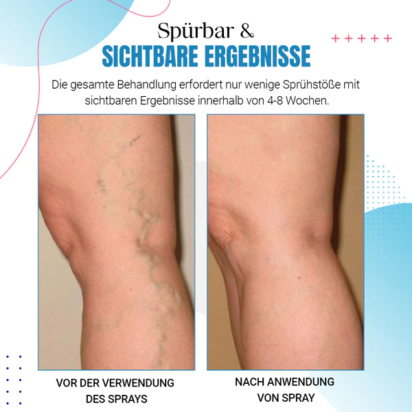 Raura™ Krampfader Behandlungsspray - Image 5