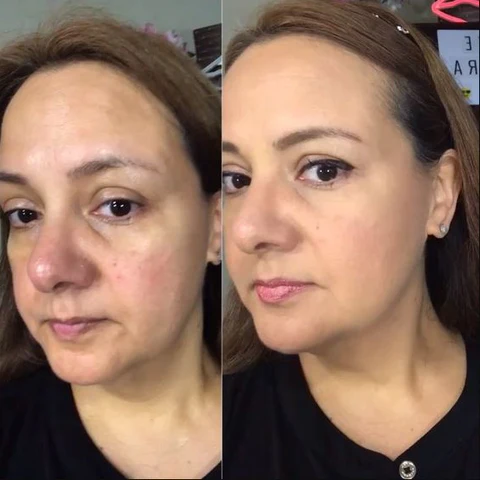 Fivfivgo™ Retinol-Schlangengift-Peptid-Goldmaske - Image 6