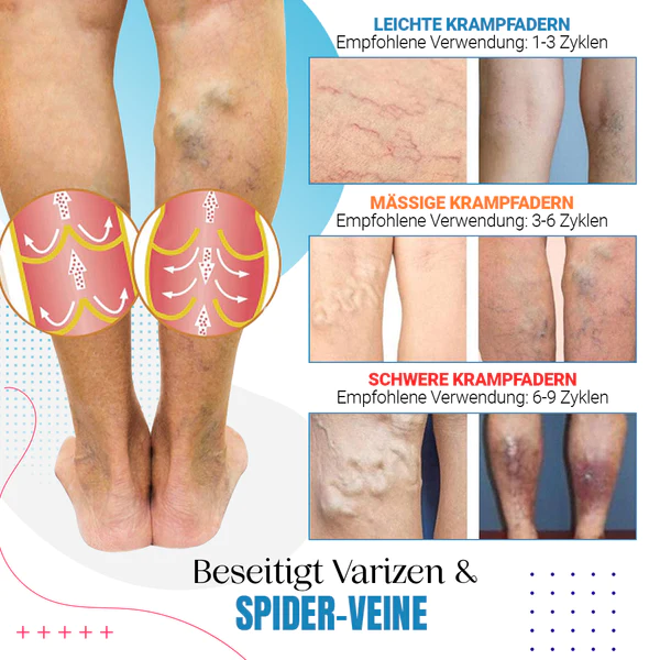 Raura™ Krampfader Behandlungsspray - Image 8