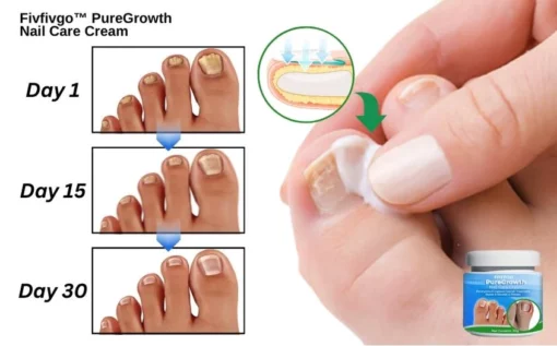 Fivfivgo™ PureGrowth Nail Care Cream