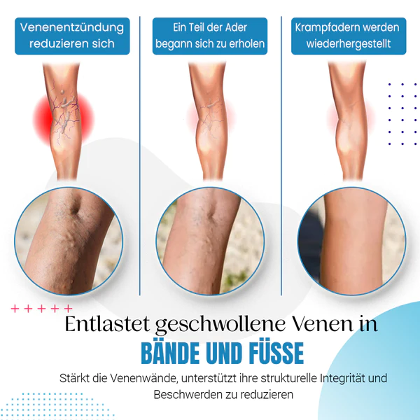 Raura™ Krampfader Behandlungsspray - Image 6