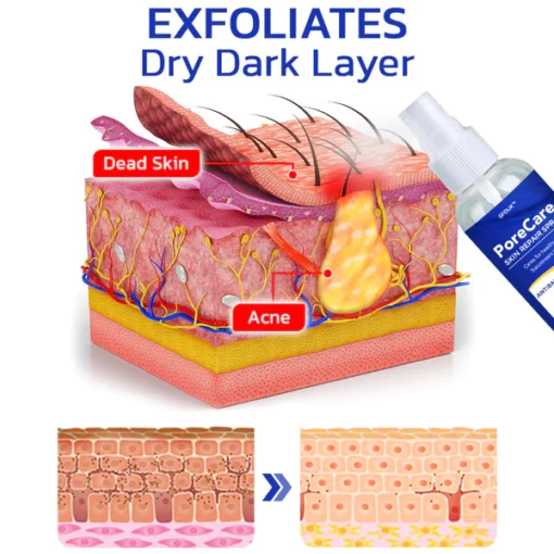 GFOUK™ PoreCare Skin Repair Spray - Image 4