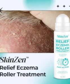 SkinZen™ Relief Eczema Roller Treatment