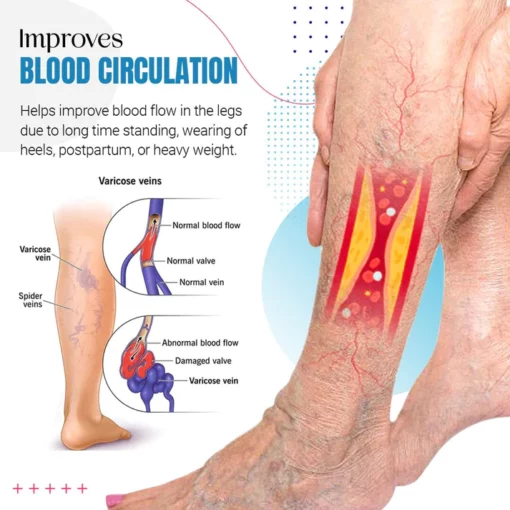 Raura™ Varicose Veins Treatment Spray - Image 4