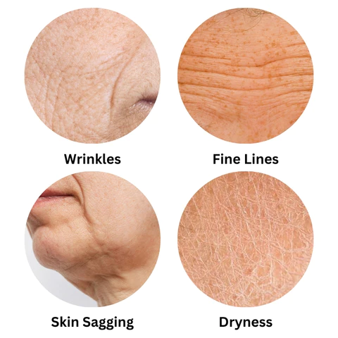 Fivfivgo™ Retinol-Schlangengift-Peptid-Goldmaske - Image 3