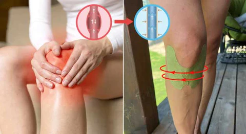 COROU™️ – Natural Knee Pain Patches - Image 4