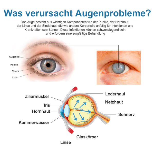 Ourlyard™ Augentropfen zur Behandlung von Sehproblemen - Image 6