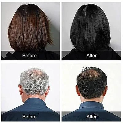 Yaguan Herbal Black Dew Shampoo - Image 8