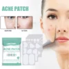 Acne Patches