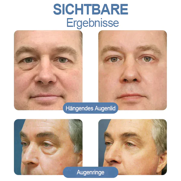 Jorondy™ Awaken Peptide Lifting Eye Gel - Image 9