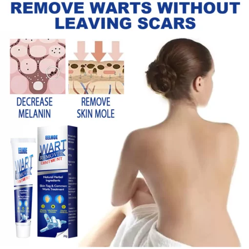 Jusbj™ WartsOff Instant Blemish Removal Cream - Image 2