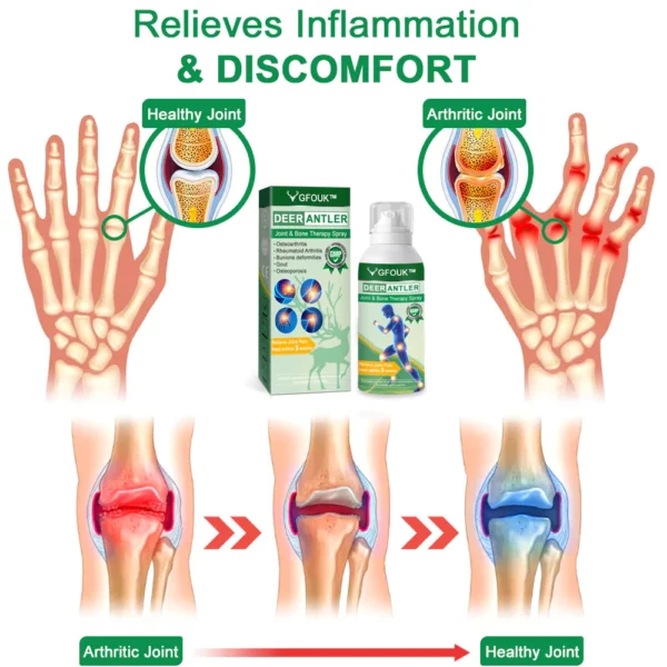 GFOUK™ DeerAntler Joint and Bone Therapy Spray - Image 7