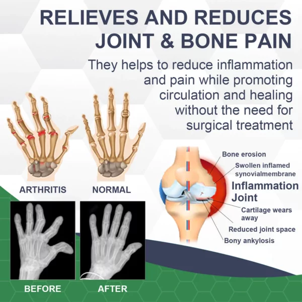 LERCEA™ Bee Venom Pain and Bone Healing Cream - Image 6