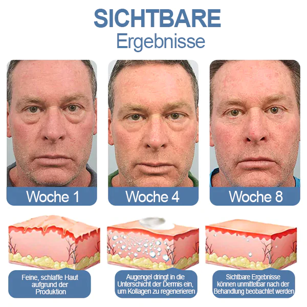 Jorondy™ Awaken Peptide Lifting Eye Gel - Image 7