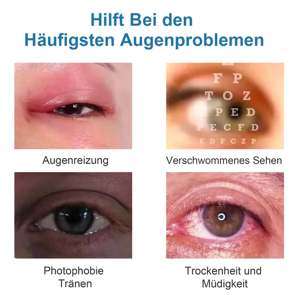 Ourlyard™ Augentropfen zur Behandlung von Sehproblemen - Image 9