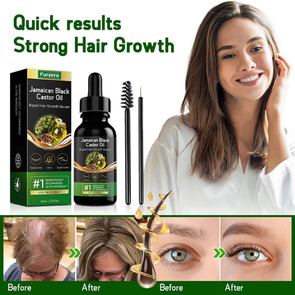 Furzero™ Jamaican Black Castor Oil Rapid Hair Growth Serum - Image 5