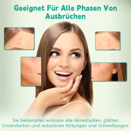 Biancat™ GentleCare Akne-Heilpflaster - Image 3