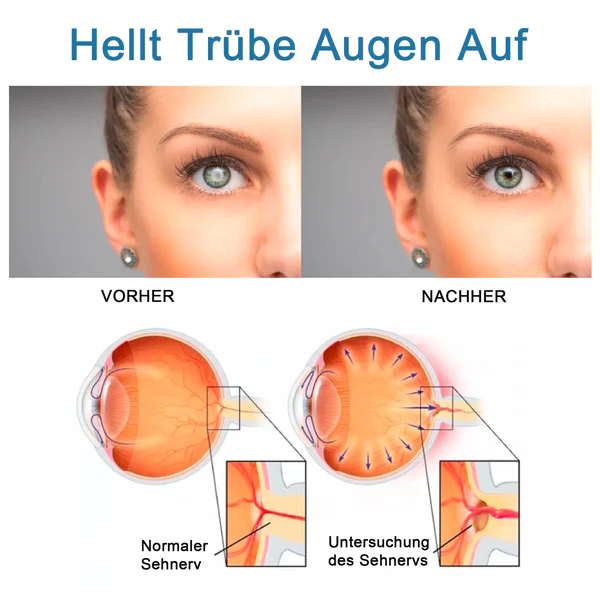 Ourlyard™ Augentropfen zur Behandlung von Sehproblemen - Image 11