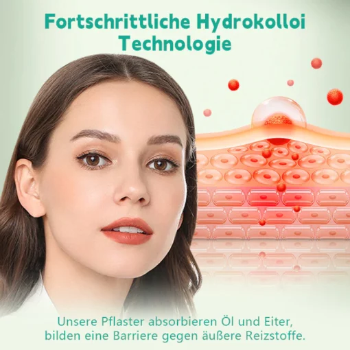 Biancat™ GentleCare Akne-Heilpflaster - Image 4