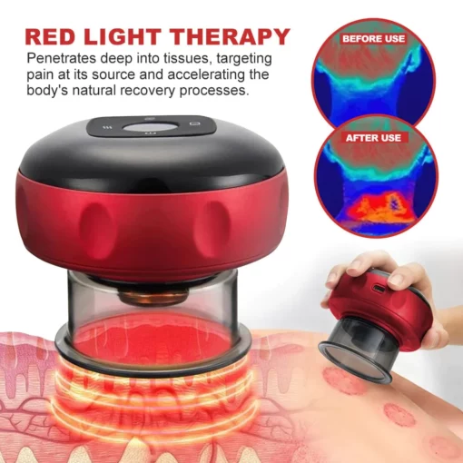 KISSHI Instant Pain Relief Ultimate Cupping Tool - Image 5