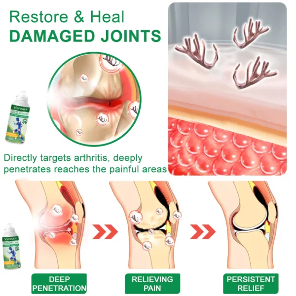 GFOUK™ DeerAntler Joint and Bone Therapy Spray - Image 5