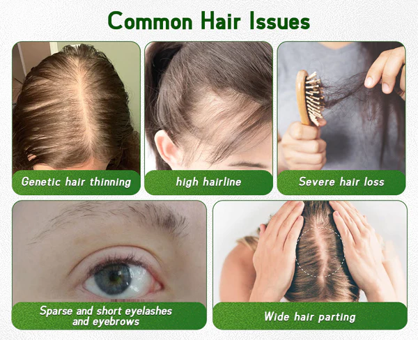 Furzero™ Jamaican Black Castor Oil Rapid Hair Growth Serum - Image 4