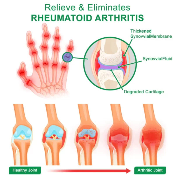 GFOUK™ DeerAntler Joint and Bone Therapy Spray - Image 3