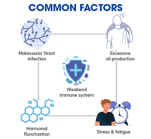 GFOUK™ Seborrheic Dermatitis Cream - Image 6