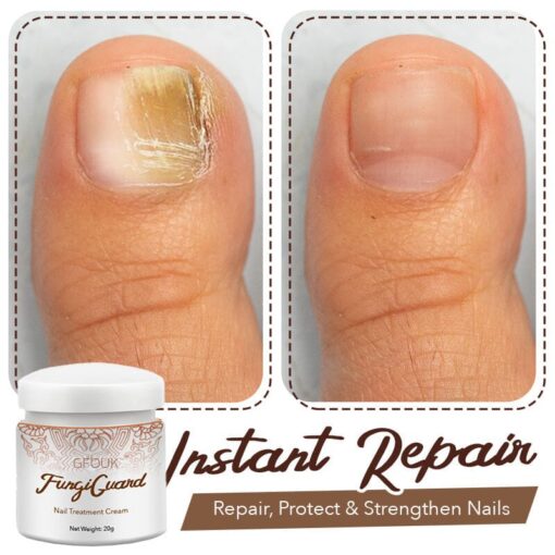 GFOUK™ FungiGuard Nail Treatment Cream - Image 7
