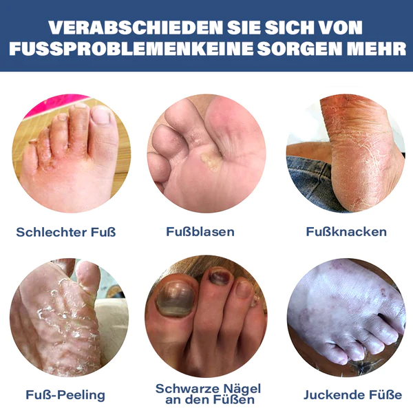 Furzero™ Medizinisches Nagelpilz-Fußspray - Image 9