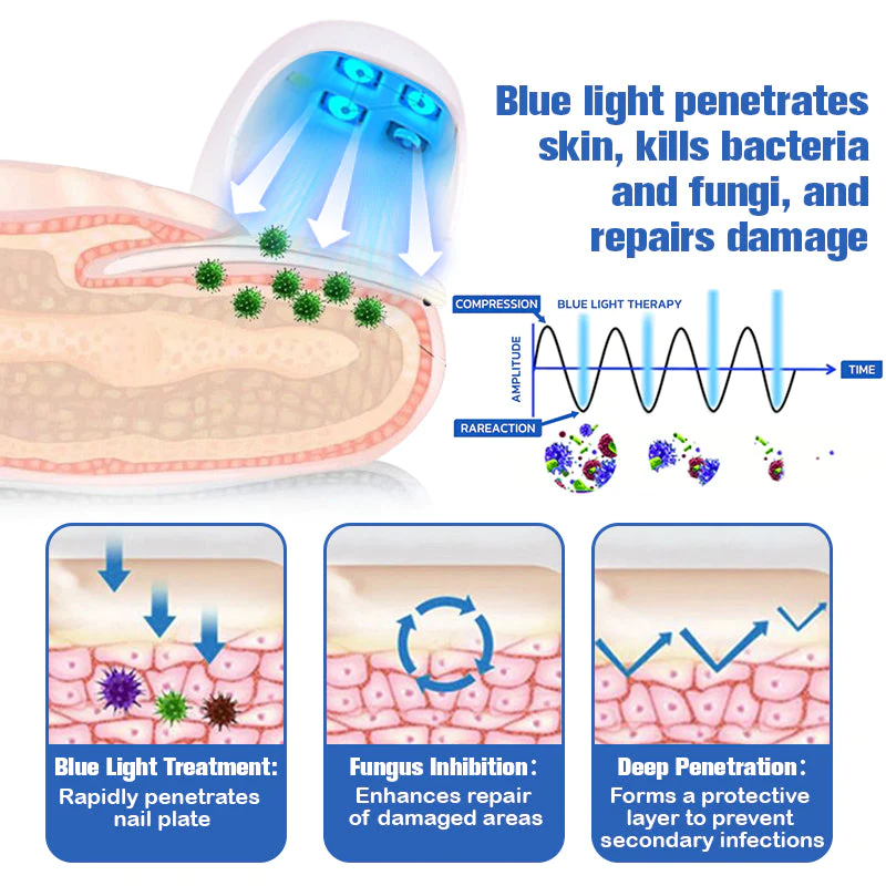 Furzero™ Nail Fungus Cleaning Laser Relief Device - Image 3