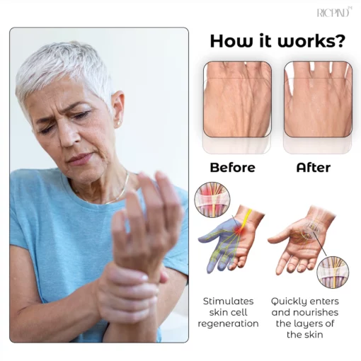 RICPIND Titanium Ionized Far Infrared Therapy ArthritisRelief Gloves - Image 4