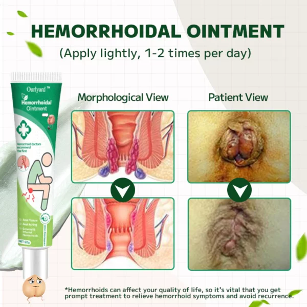 Ourlyard™ Hemorrhoidal Ointment - Image 7