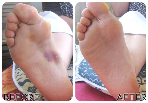 Fivfivgo™ EaseNerve Hands and Foots Patch - Image 6