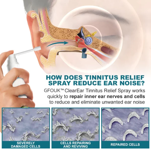 GFOUK™ ClearEar Tinnitus Relief Spray - Image 4