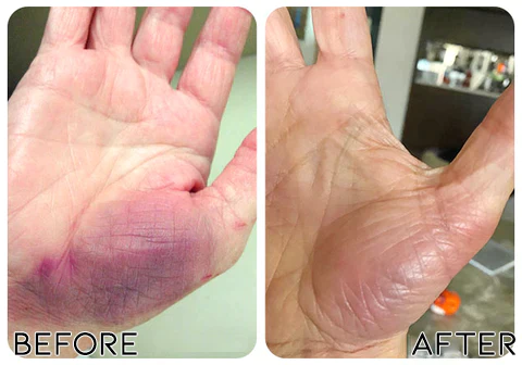 Fivfivgo™ EaseNerve Hände und Füße Pflaster - Image 4