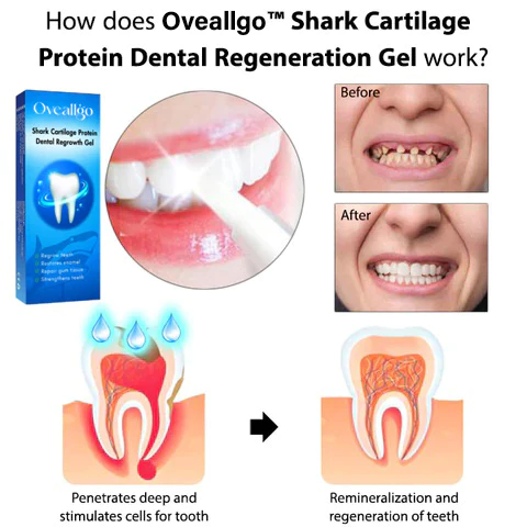 Oveallgo™ Shark Cartilage Protein Dental Regeneration Gel - Image 5