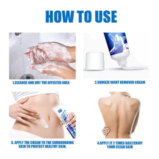 Jusbj™ WartsOff Instant Blemish Removal Cream - Image 4