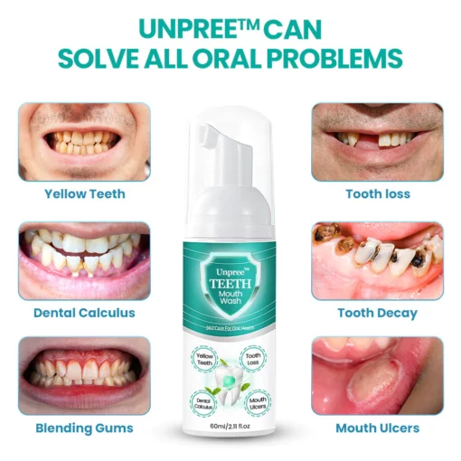 Unpree TEETH Mouthwash - Image 8