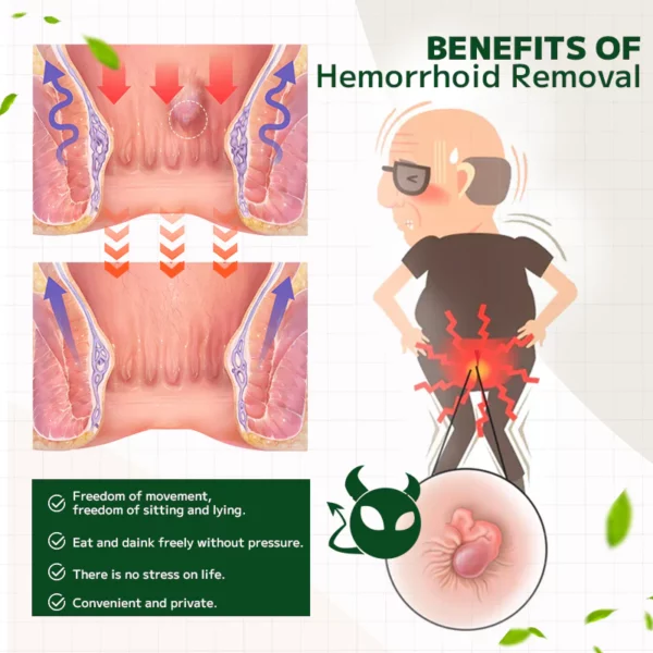 Ourlyard™ Hemorrhoidal Ointment - Image 6