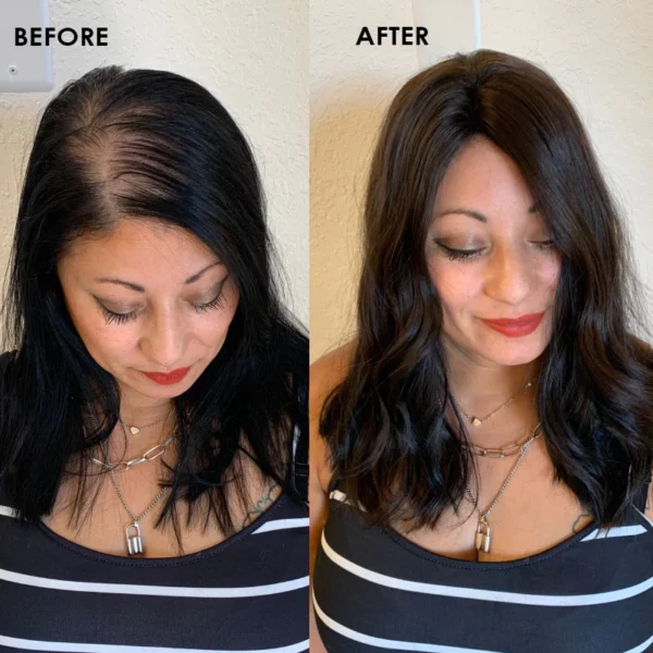 Sugoola™ Heiztherapie-Haarmaske zur Förderung des Haarwuchses - Image 13