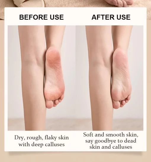 Nurbini™ Crystal Peeling Pedicure Board - Image 5