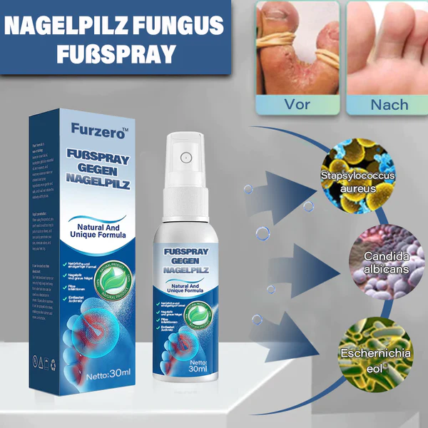 Furzero™ Medizinisches Nagelpilz-Fußspray - Image 2