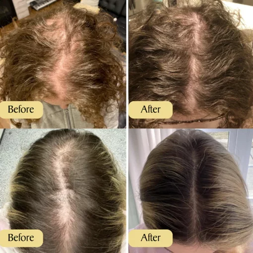 LIMETOW™ Natural Vegan Hair Growth Oil - Image 3