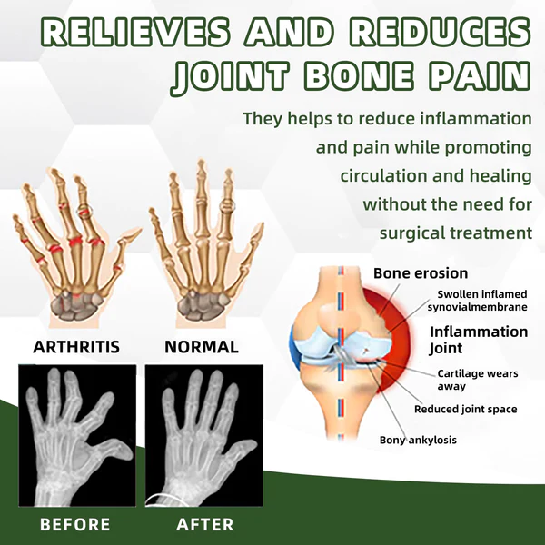 LIMETOW™ Australian honey bee Venom Pain and Bone Healing Cream - Image 4