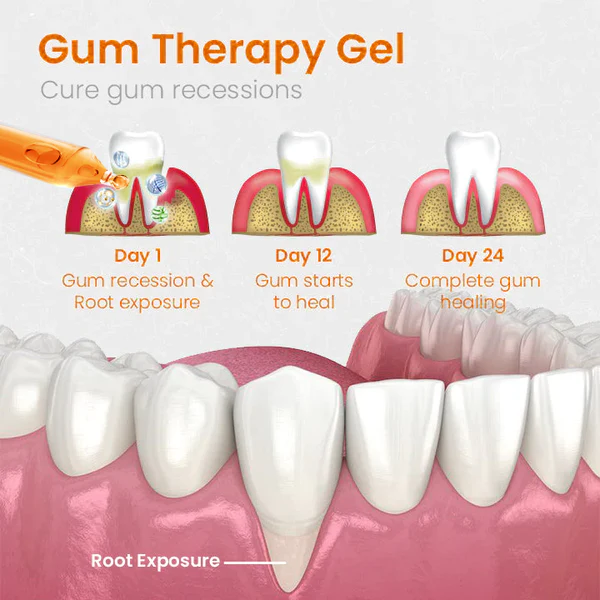 Hudros™ Gum Repair Treatment Ampoules - Image 6