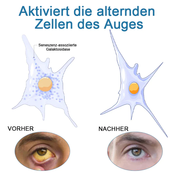 Ourlyard™ Augentropfen zur Behandlung von Sehproblemen - Image 7