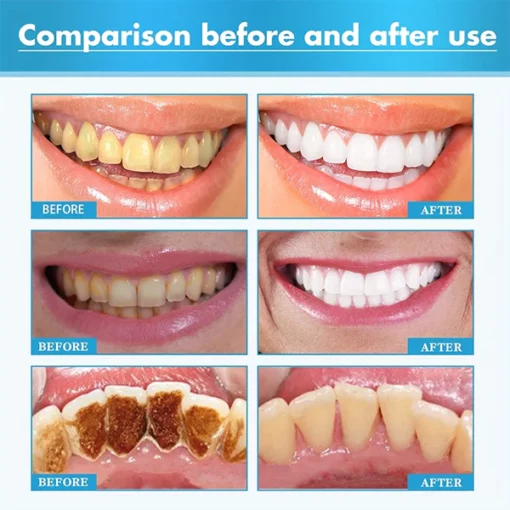 Fivfivgo™ Pflanzlicher aufhellender Reparaturschaum für den Mund - Image 4